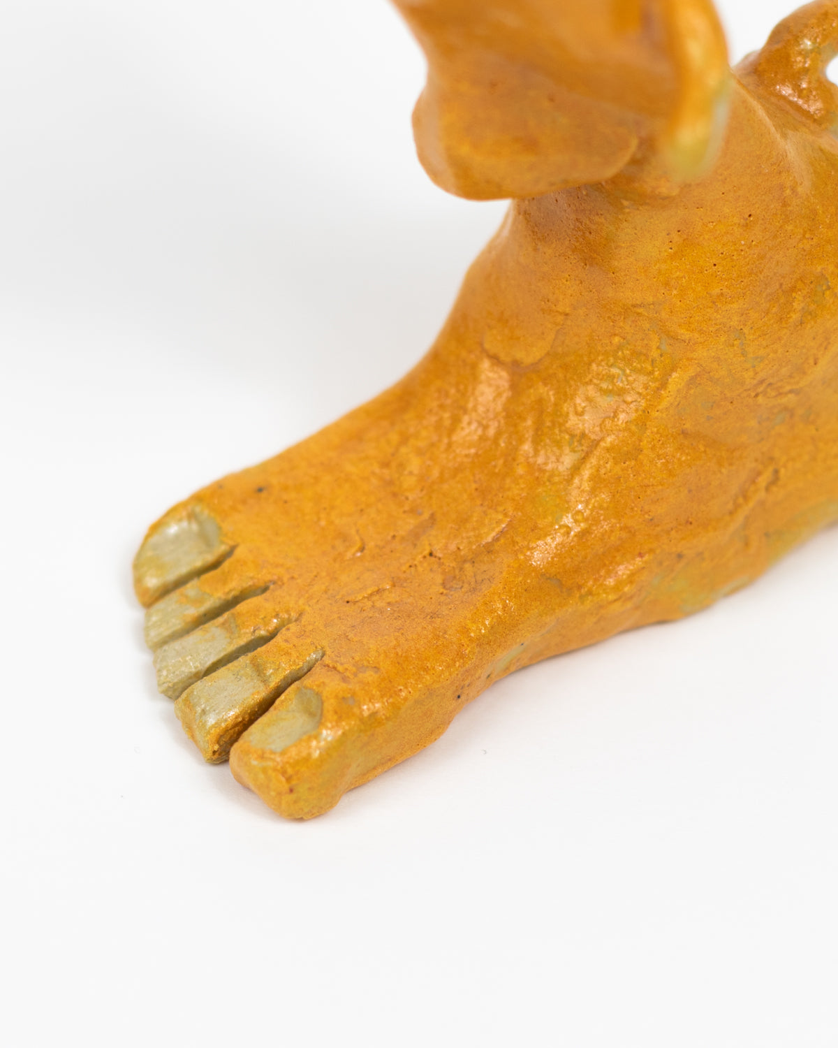 Cerumen obturans