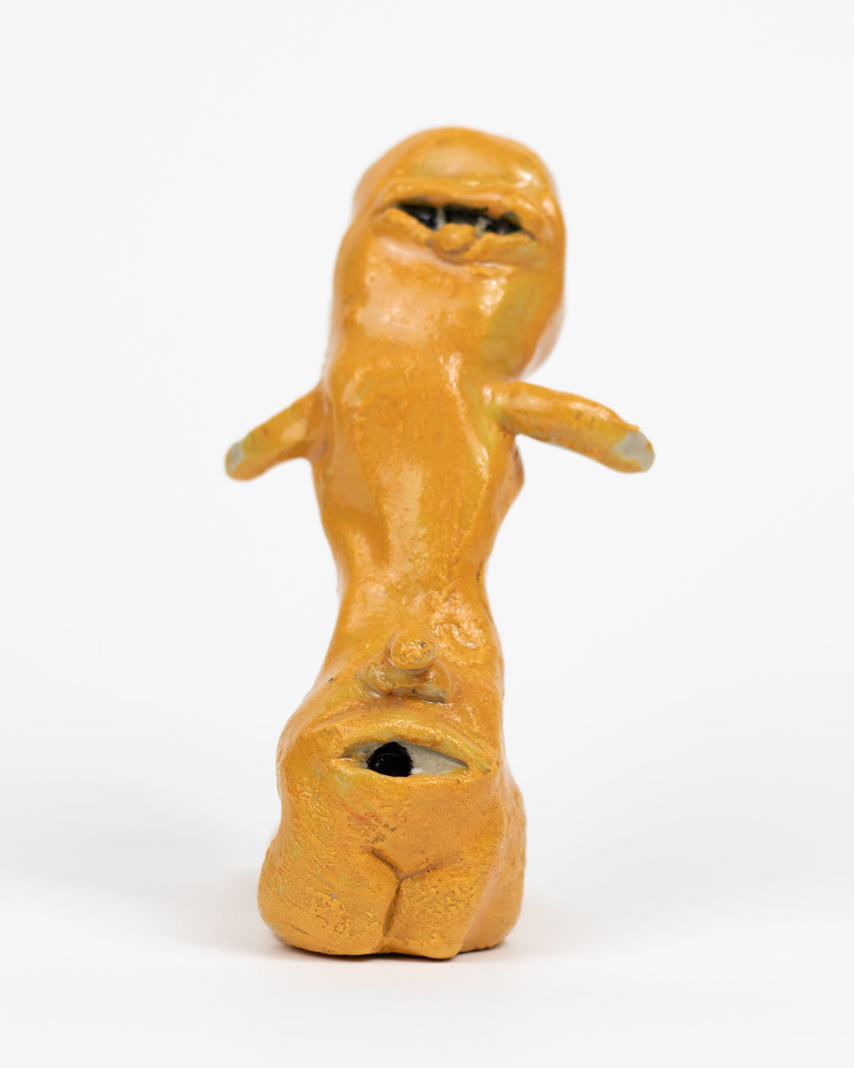Cerumen obturans